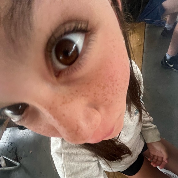 Meet your Posher, Remedy - Picture 1 of 1